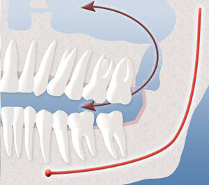 sinus communication