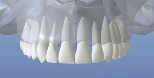Normal Mouth